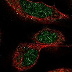 BTBD9 Antibody, Novus Biologicals 0.1mL; Unlabeled:Antibodies, Polyclonal